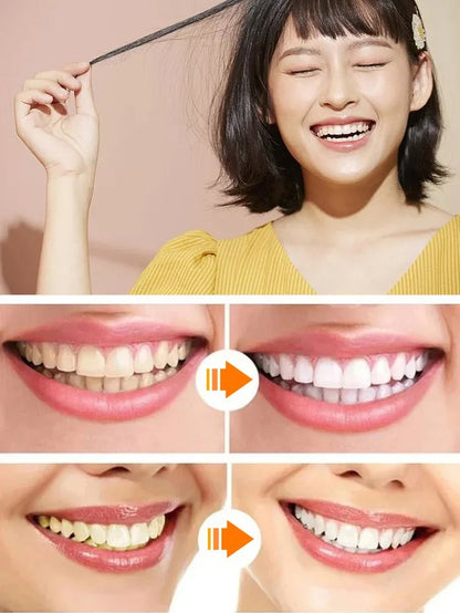 着脱可能な美白付け歯